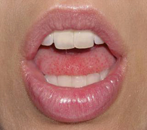 A photo of lips with gloss.